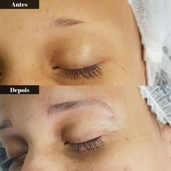 Sobrancelhas antes e depois do procedimento de microblading fio a fio 3D, mostrando um preenchimento natural e simétrico.